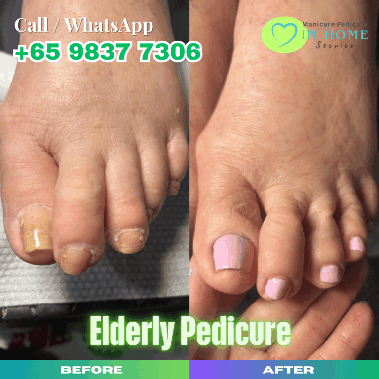 Elderly Pedicure Singapore