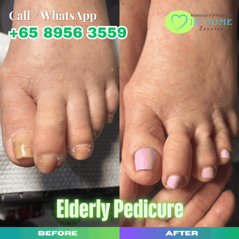 Elderly Pedicure Singapore