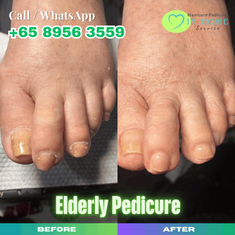 Elderly Pedicure Singapore