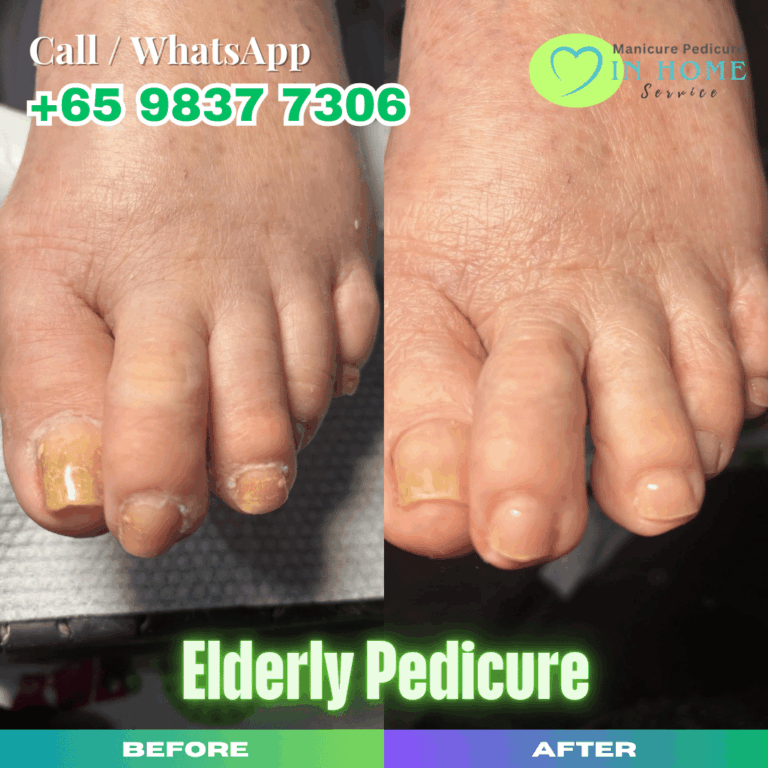 Elderly Pedicure Singapore