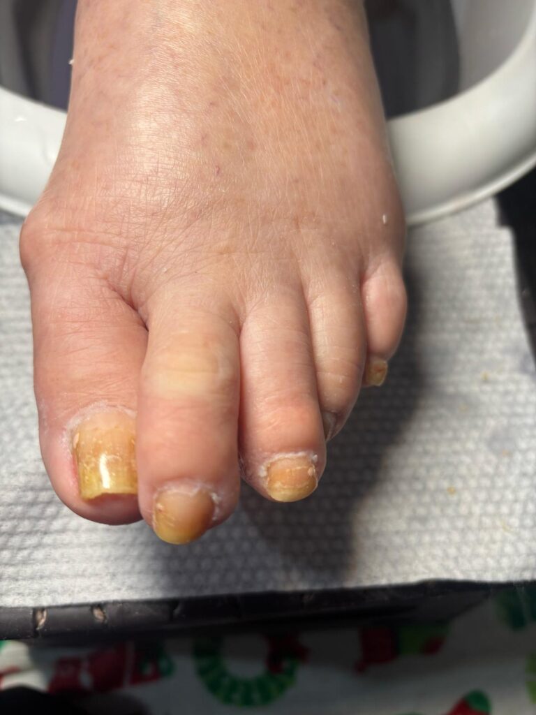 elderly manicure before and after