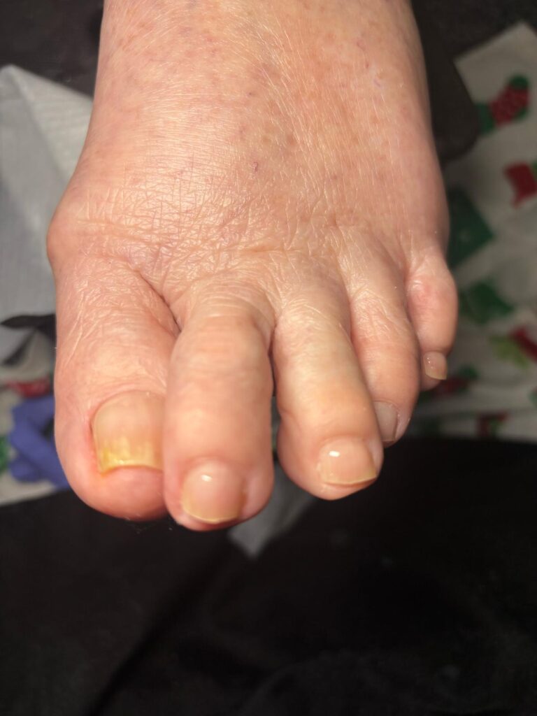 elderly manicure before and after