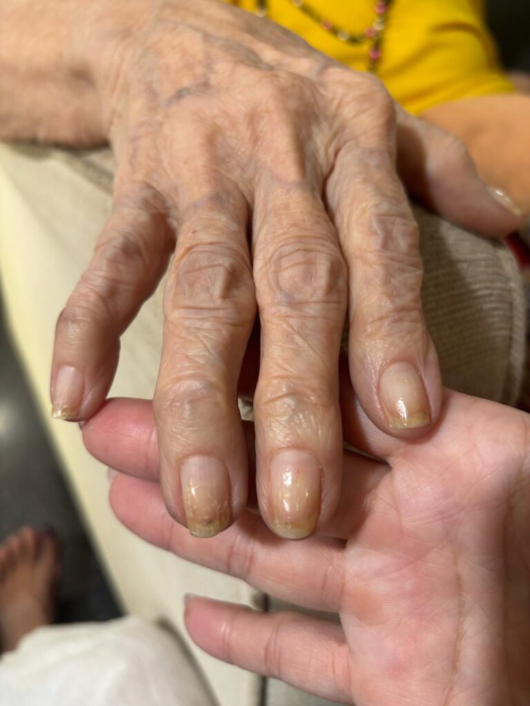 elderly manicure before and after
