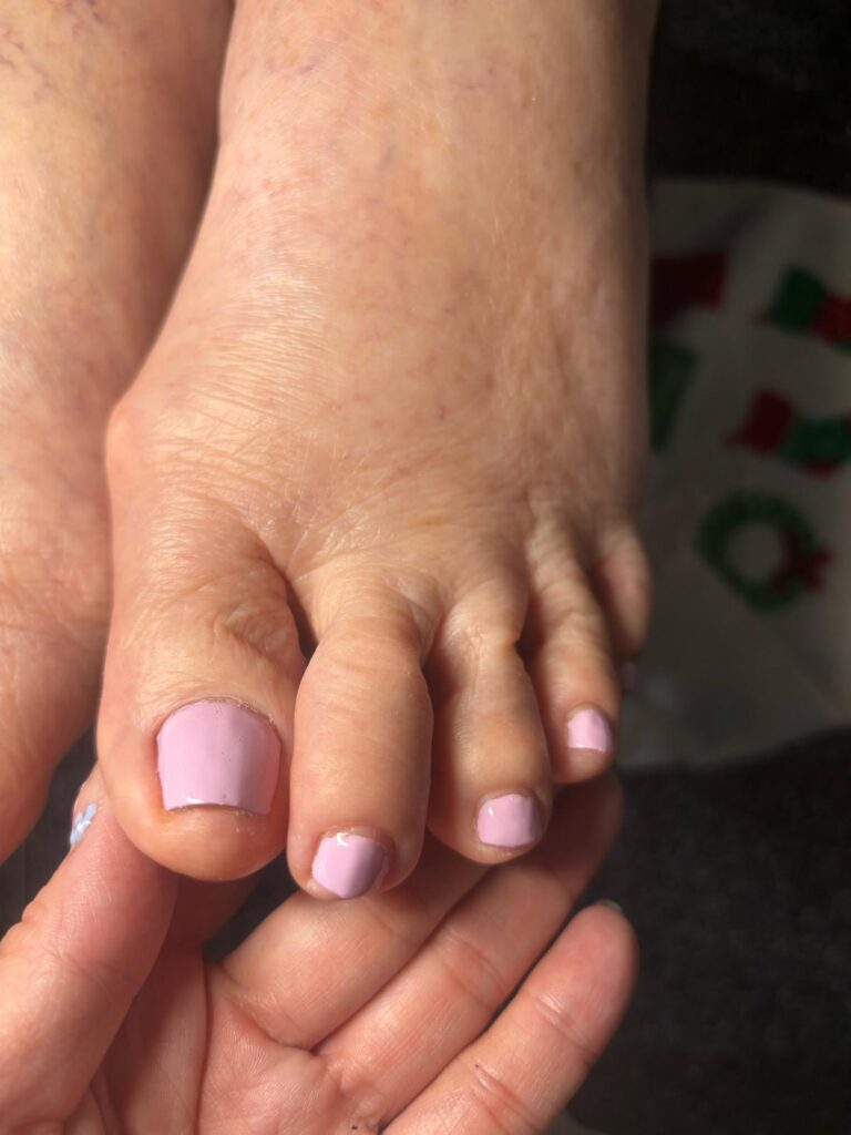 elderly manicure before and after